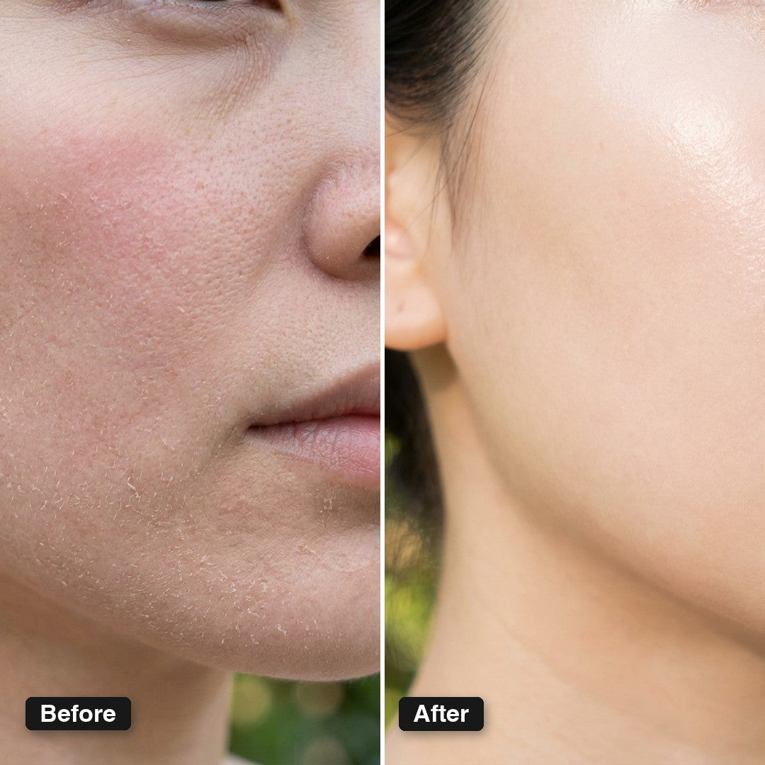 Before and after — tight, flaky cheeks turned smooth